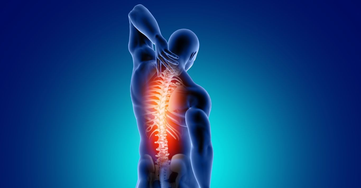 Rückenschmerzen verschiedenster Ausprägungen